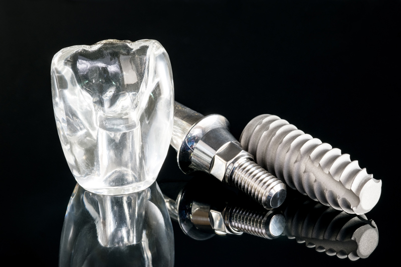 Enhancing Your Smile: Discover the Perks of Top Teeth Dental Implants