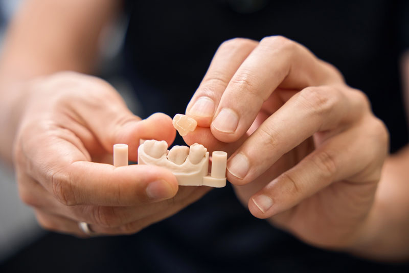 Close-up of hands holding a dental model and placing a crown on an implant to demonstrate restorative dentistry.
